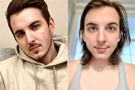 Trans MrBeast star Kris Tyson shares before and after photos